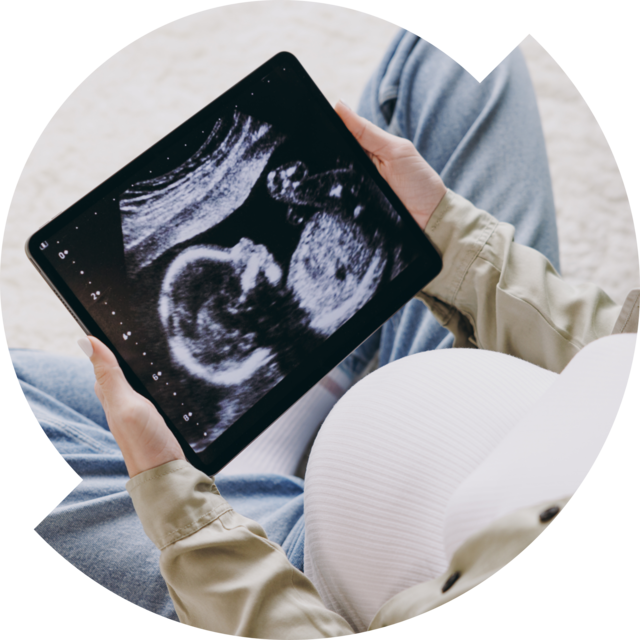 Schwangere Person blickt auf ein Ultraschallbild eines Fetus.