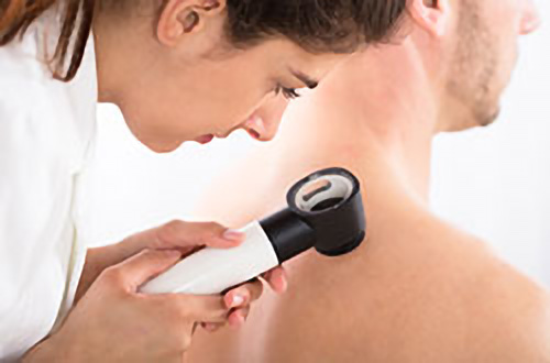 Ein Arzt untersucht den Rücken eines Mannes bei einer Hautuntersuchung mit einem Dermatoskop.